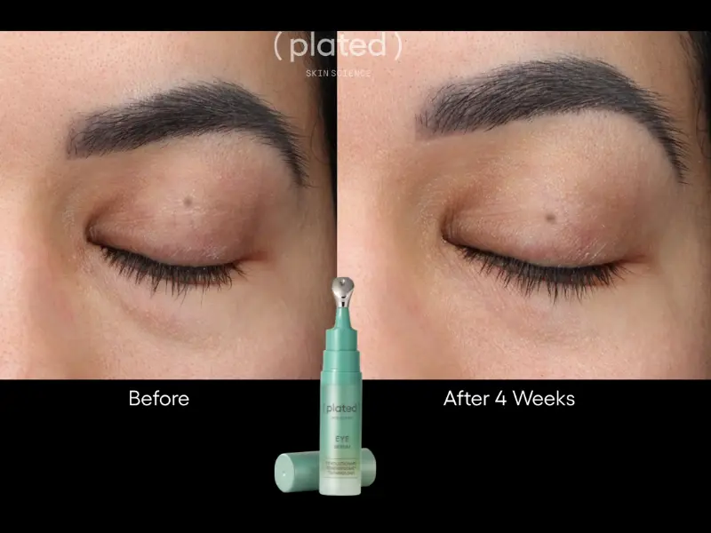 EYE Serum BA 1