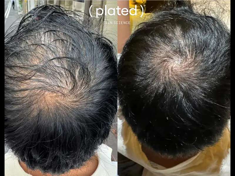 HAIR BA 1